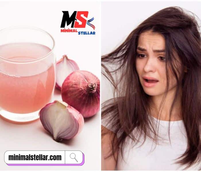 10 natural remedies to stop hair fall